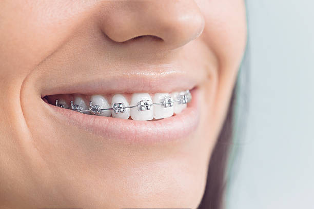 Best Dental Implants  in Hainesvle, IL